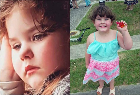 Niña de cinco años sufre menopausia por extraña enfermedad