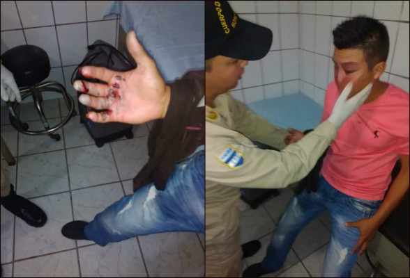 Honduras: 30 quemados dejaron fiestas de diciembre