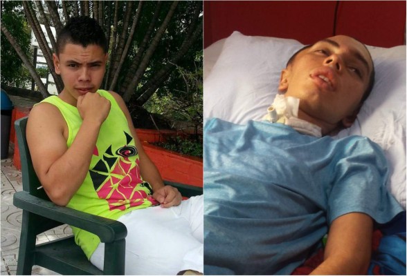 'Quiero que mi hijo se levante de esa cama': la aguerrida madre del universitario que lleva un año luchando por vivir