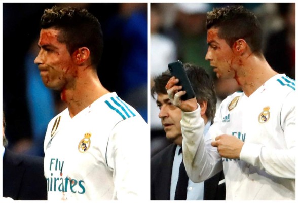 Cristiano sufrió terrible golpe y hasta pidió un celular para verse el rostro