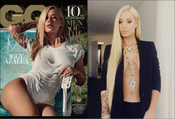 Iggy Azalea: 'Tengo la mejor vagina del mundo”