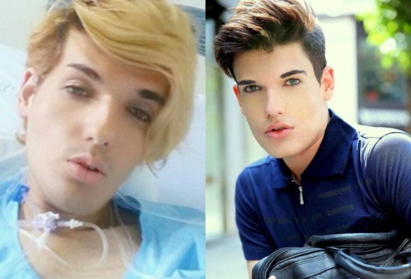 ¡Murió el Ken humano de Brasil!