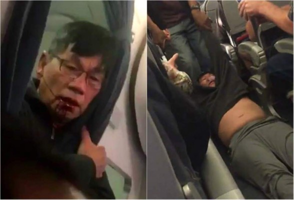 Pasajero demandará a United Airlines por expulsarlo de avión