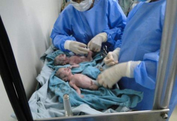 Mujer da a luz a quintillizos en Guatemala