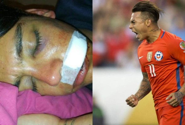 Eduardo Vargas denuncia agresión a familiares: 'No se va a quedar así'