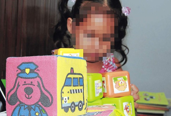 Niños sufren aguda caída de cabello por depresión