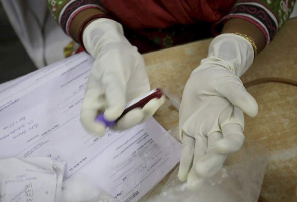 Cabotegravir, medicamento más eficaz para prevenir el Sida, según estudio