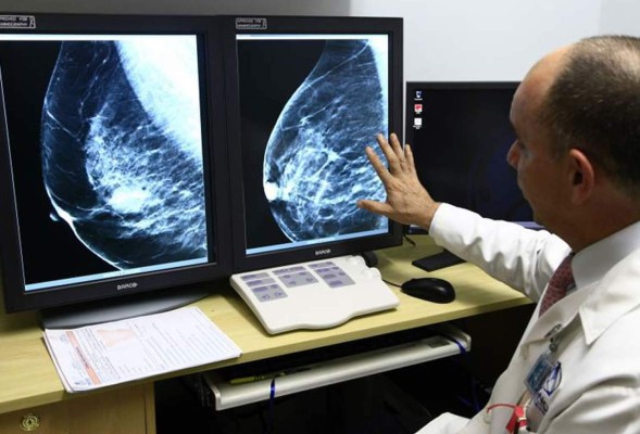 L100 costará mamografía en el hospital Mario Rivas