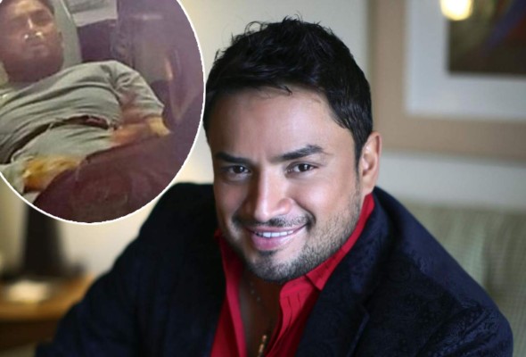 El cantante Manny Manuel sufre fuerte accidente de tránsito