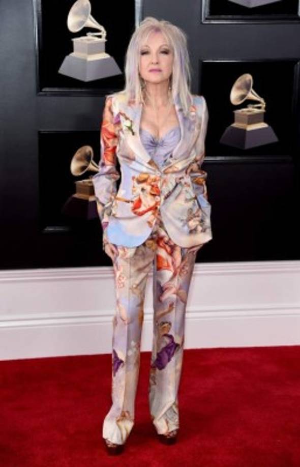 La cantante Cyndi Lauper.