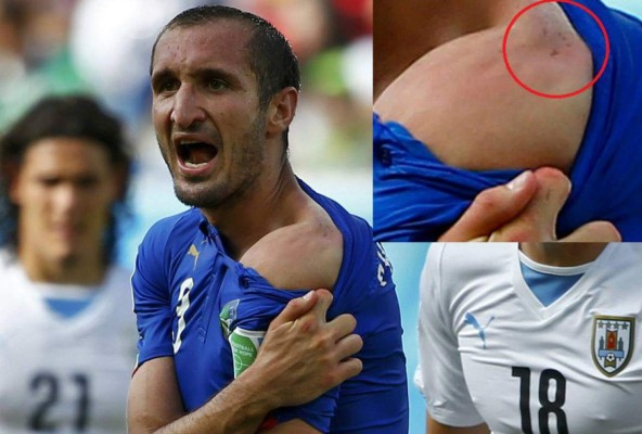 Luis Suárez reincidente: muerde a Giorgio Chellini (memes)