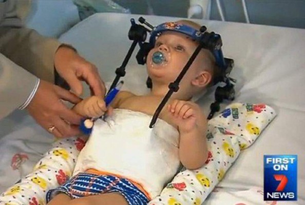 Bebé 'decapitado' en accidente vive de milagro