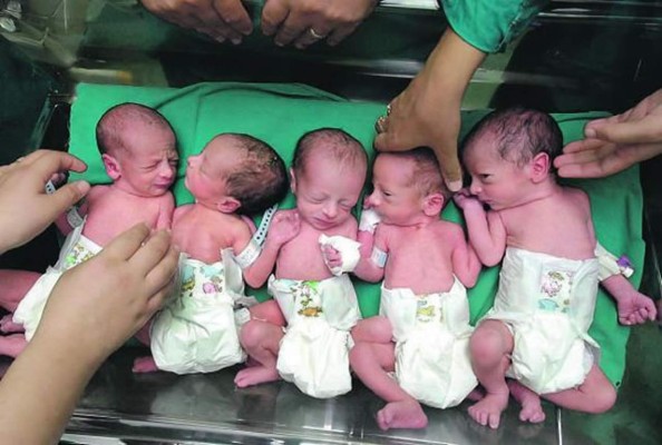 Nacen quintillizos en Venezuela