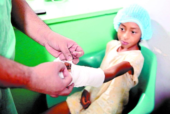 En brigada médica reconstruirán las manos a 70 personas