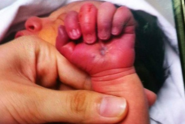 Madre caníbal intenta comerse a su bebé recién nacido