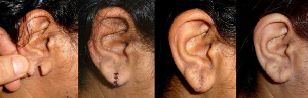 Es mago para partir lenguas, perforar piel y colorear ojos