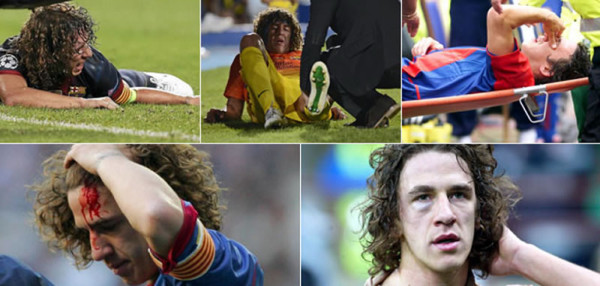 Las lesiones minaron a un Puyol que soñó ser futbolista hasta los 40 años