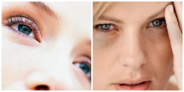 Remedios para eliminar los ojos hinchados