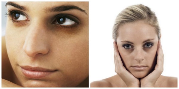 Leche para las ojeras