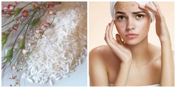 Arroz para el acné
