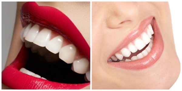 Dientes blancos de manera natural
