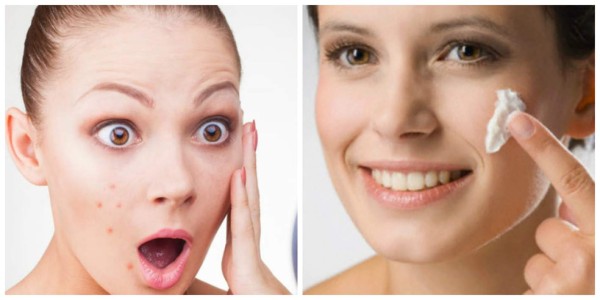 Tips para desaparecer los granos