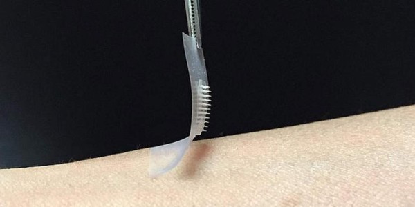 Diseñan parche de insulina para diabéticos que podría sustituir a inyecciones