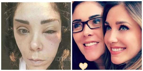 Hermana de Anahí casi muere tras cirugía estética