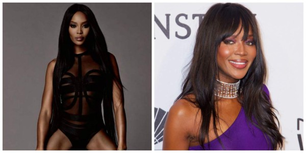 Campbell podría necesitar una prótesis