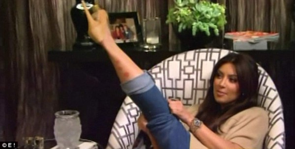 Kim Kardashian ya no puede ocultar la psoriasis