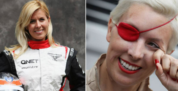 España: La expiloto María de Villota muere por causas naturales