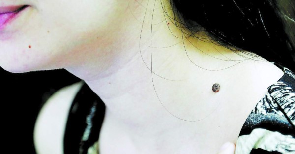 Pretenden beneficiar a más de 700 personas con campaña lunar