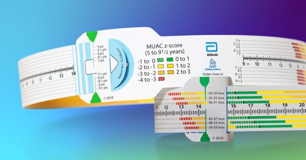Falta de proteínas y calorías puede desnutrirlos