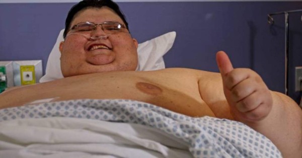 El hombre más gordo del mundo venció al Covid-19