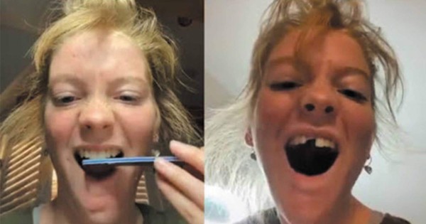 Limarse los dientes, el peligroso y nuevo reto viral de TikTok