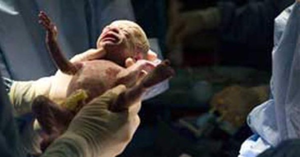 Mujer da a luz a sextillizos en EUA