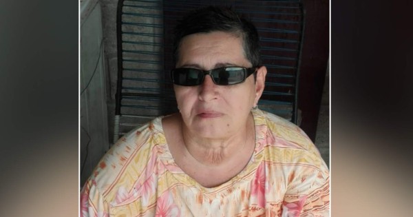 GoFundMe: hondureña pide ayuda para pagar cirugía que salvará su vista