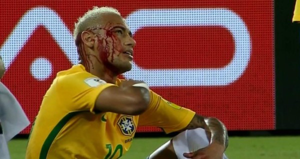 Boliviano del codazo a Neymar: 'Tiene que respetar a sus rivales'