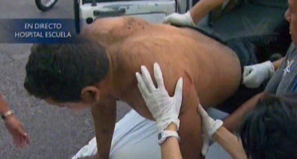 Vuelco de bus interurbano deja un muerto y unos 27 heridos en el sur de Honduras