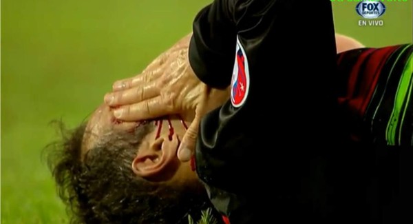 Video: Ricardo Carvalho sufrió tremenda cortada