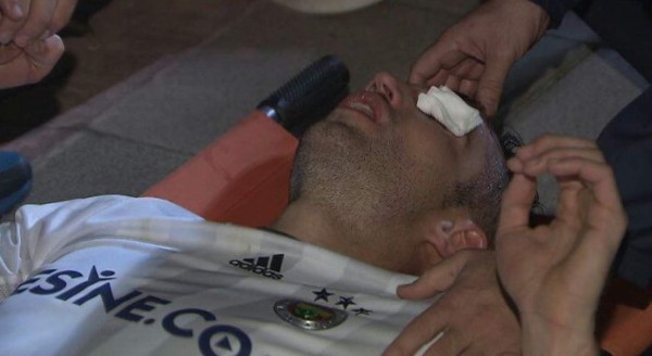 ¡Lamentable! Van Persie puede perder un ojo tras este golpe