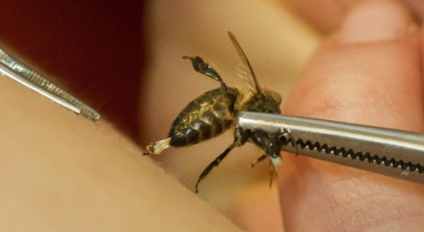 Brasil iniciará primeros test en humanos de suero contra picaduras de abeja ﻿