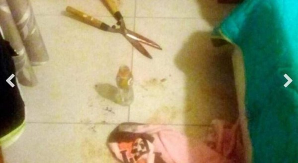 Mujer argentina mutila genitales de su amante con tijera de podar