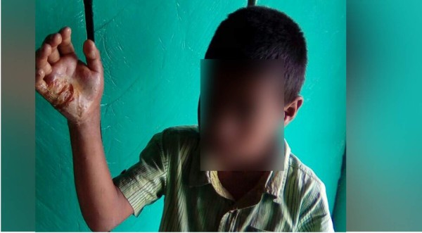 Madre mete las manos de su hijo al fuego porque no hizo mandado