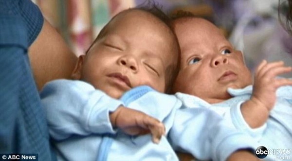 Nacen gemelos idénticos con 24 días de diferencia en Boston&nbsp;&nbsp;