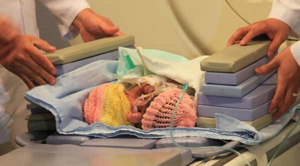 Padre de las siamesas clama por ayuda urgente