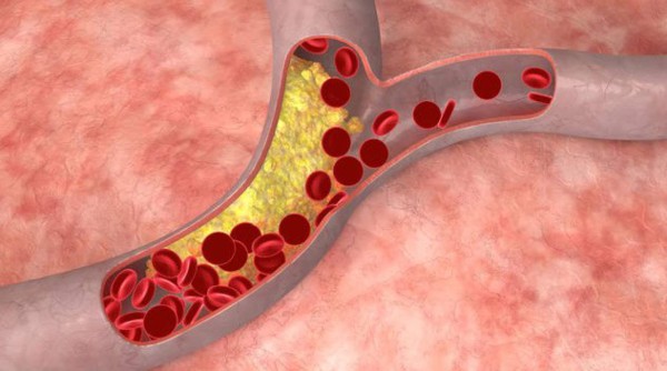 'Nano-drones' pueden combatir el colesterol en la sangre