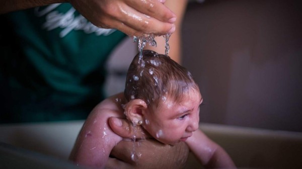 Nacen en Honduras 8 bebés con microcefalia por Zika
