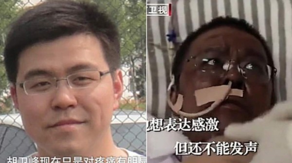 La piel de dos doctores sobrevivientes del coronavirus en Wuhan se vuelve oscura