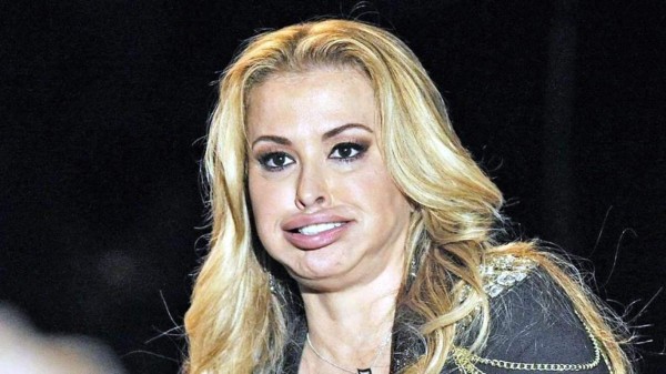 ¿Qué le pasó en la cara a Anastacia?